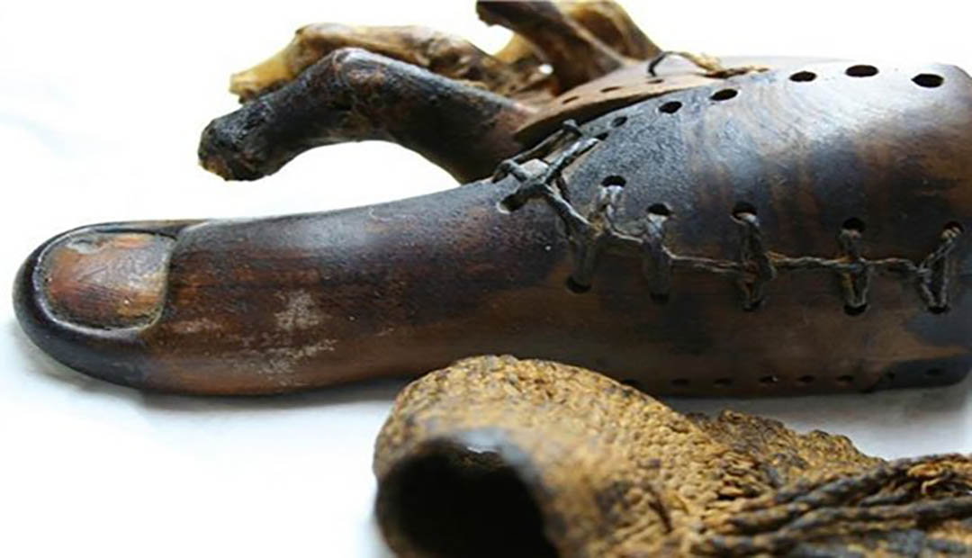 3,000-Year-Old Prosthetic Toe