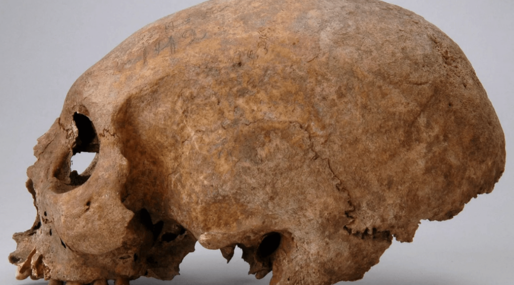 Three Viking Women With Strange Skull Modifications Discovered on Gotland