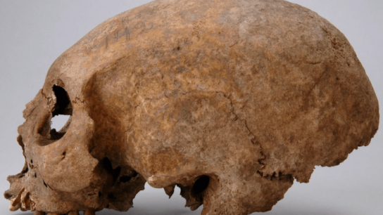 Three Viking Women With Strange Skull Modifications Discovered on Gotland