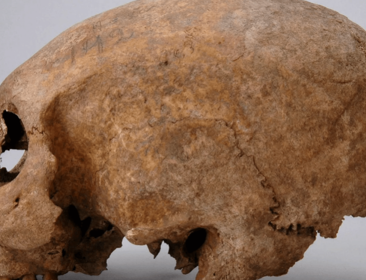Three Viking Women With Strange Skull Modifications Discovered on Gotland
